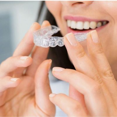 Braces and Aligners