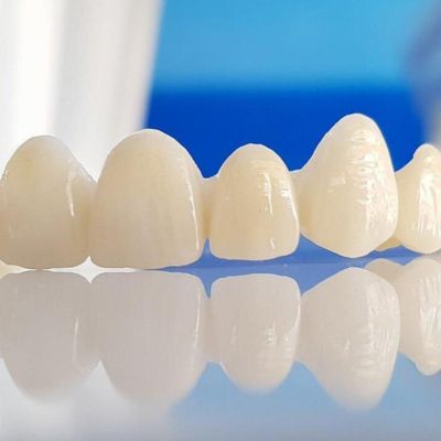 Dental Capping- Zirconia and PFM