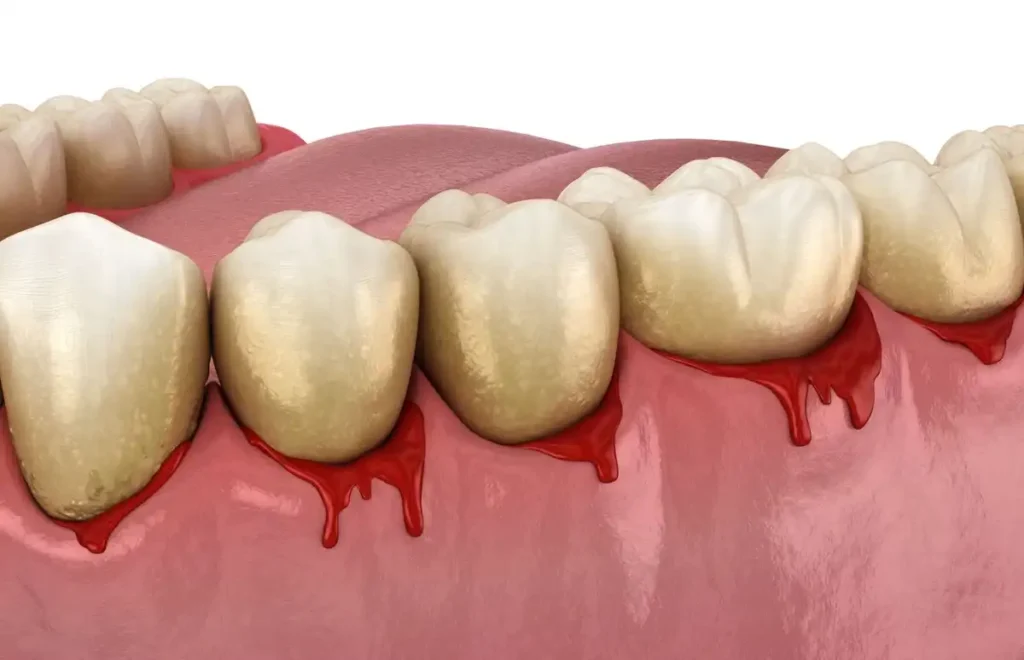 Bad Breath to Bleeding Gums