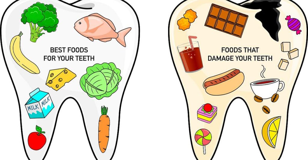 How Your Diet Affects Your Dental Health – Dentist Approved Tips