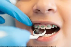 kids orthodontic