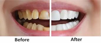 Dental Clinic Near me