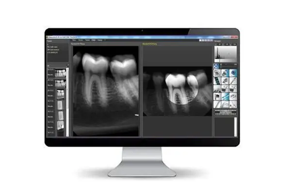 Digital X-ray imaging for accurate tooth diagnosis at Family Dental Clinic Multispeciality Centre, dentist in Sector 70 Noida
