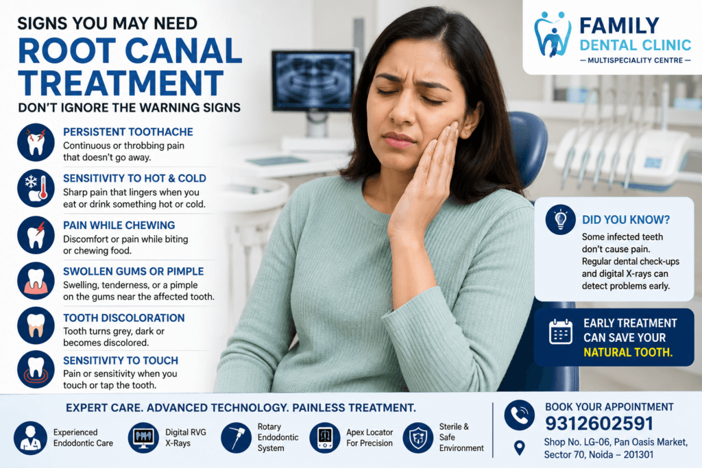 Common signs that indicate you may need root canal treatment including toothache, sensitivity and swollen gums